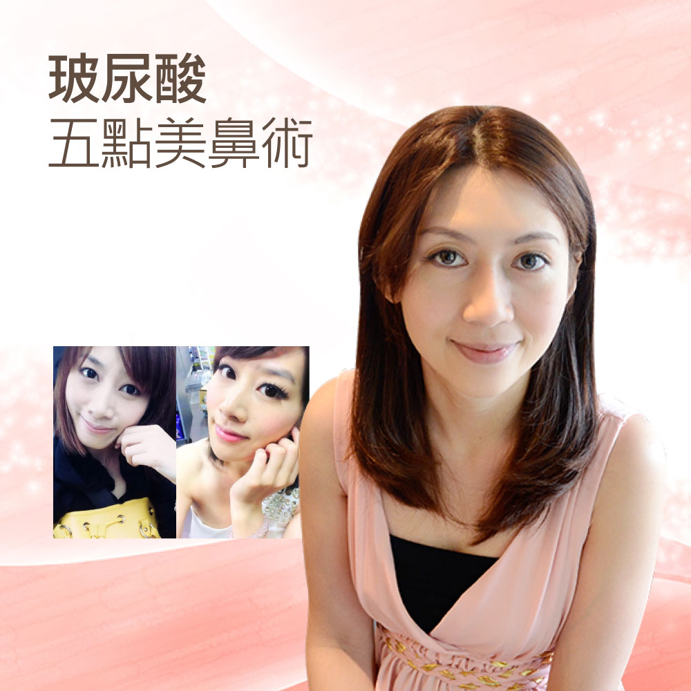 美容廣告主圖：微笑的亞洲女性，穿粉色連衣裙，左上有中文字「玻尿酸五點美鼻術」，左下方為兩張臉部近照。
