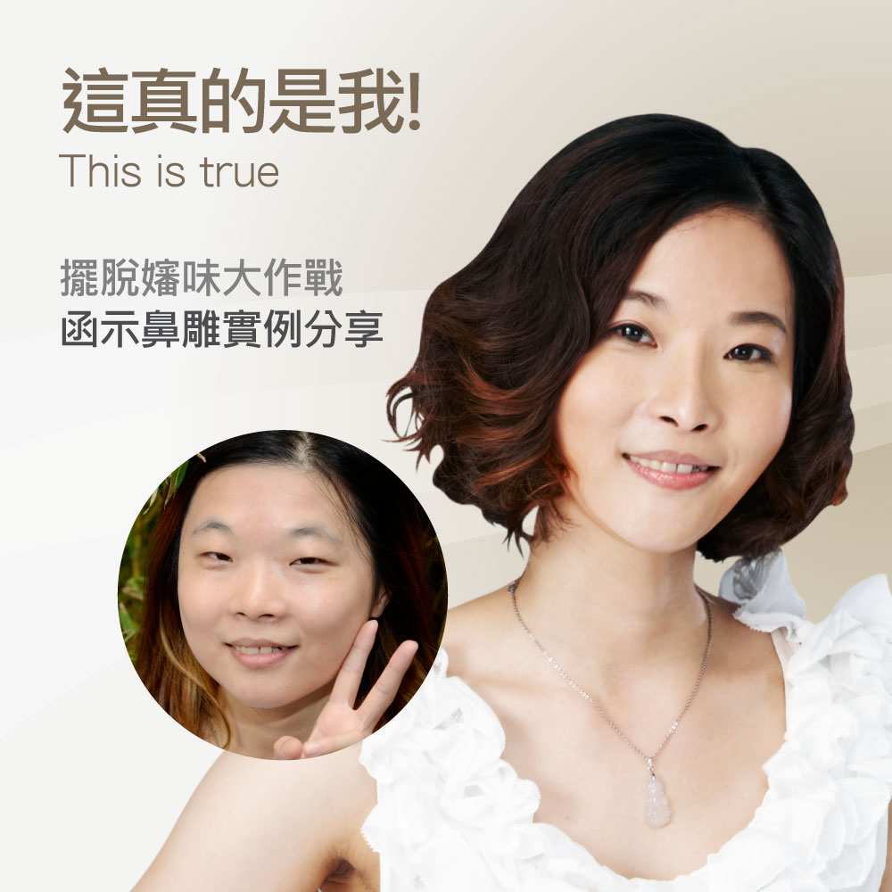 Promotional banner featuring a smiling woman with styled hair and a circular inset showing a before photo; text reads 'This is true' and Chinese slogan about nose sculpting.