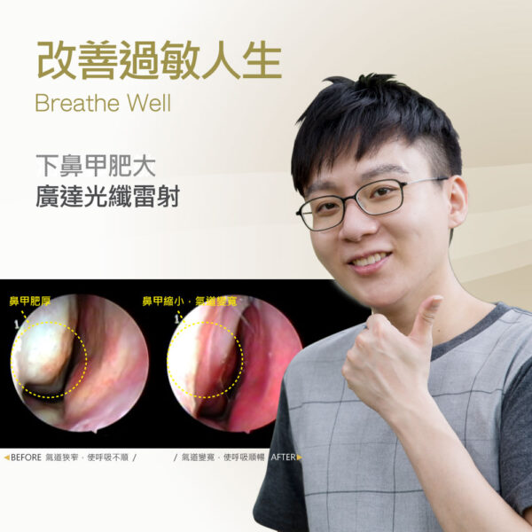 Smiling man with glasses giving a thumbs-up beside before/after nasal airway images showing improved breathing; text reads 'Breathe Well' and Chinese slogan about improving life.