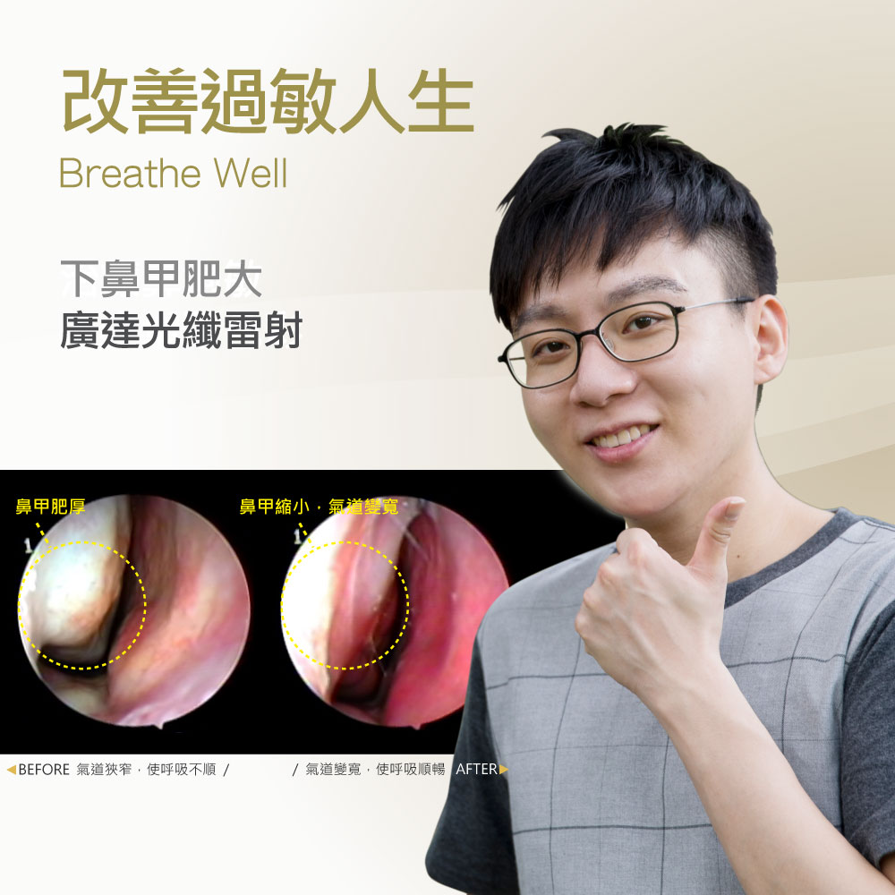 Smiling man with glasses giving a thumbs-up beside before/after nasal airway images showing improved breathing; text reads 'Breathe Well' and Chinese slogan about improving life.