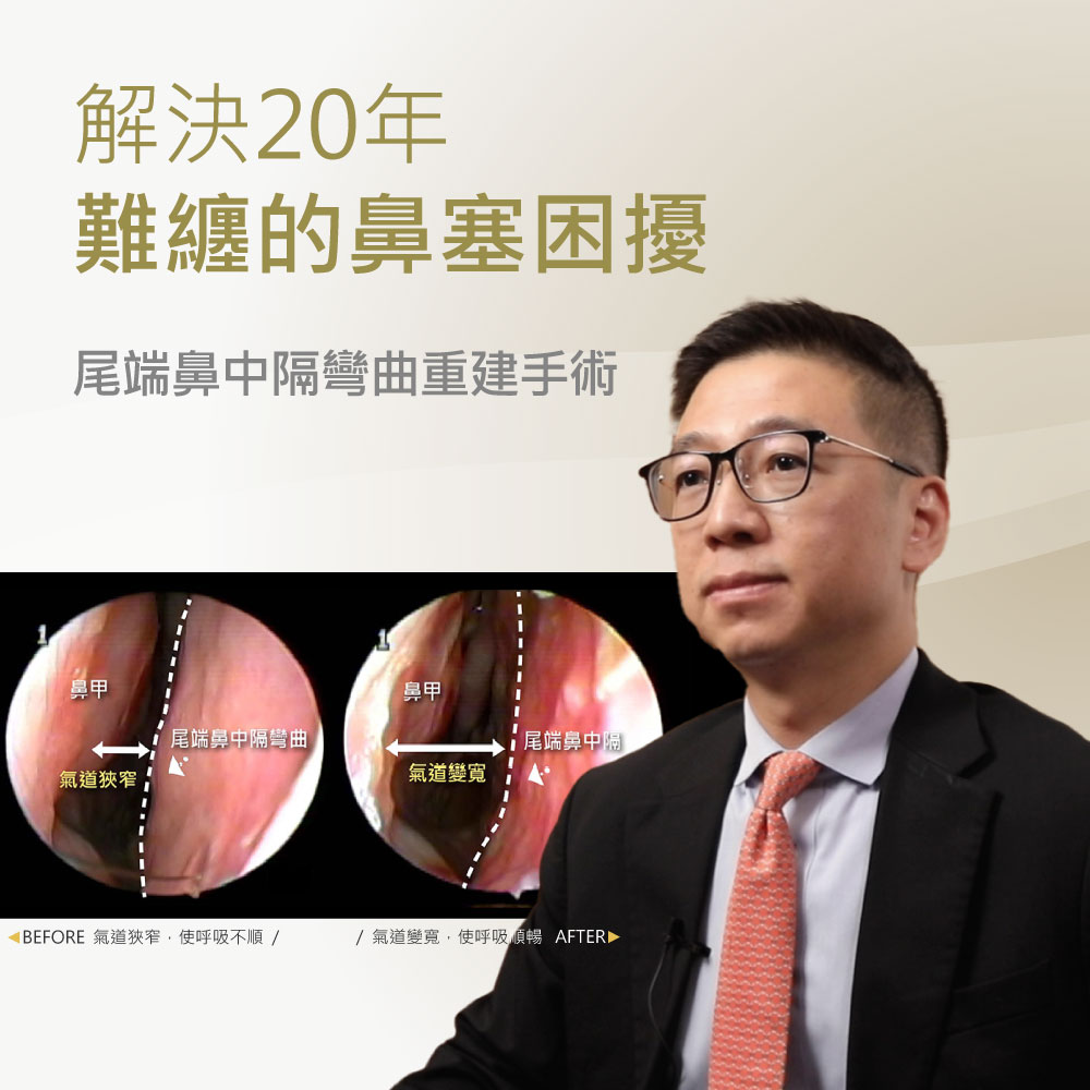 醫師穿西裝與領結講解鼻腔矯正手術如何緩解長期鼻塞，畫面含前後對照的鼻腔示意圖。前景為講解者，左下有解剖圖與比較圖。