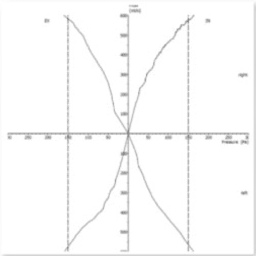 歪鼻案例分享iSkinNose-D小姐-6