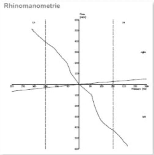 歪鼻案例分享iSkinNoseP先生-5