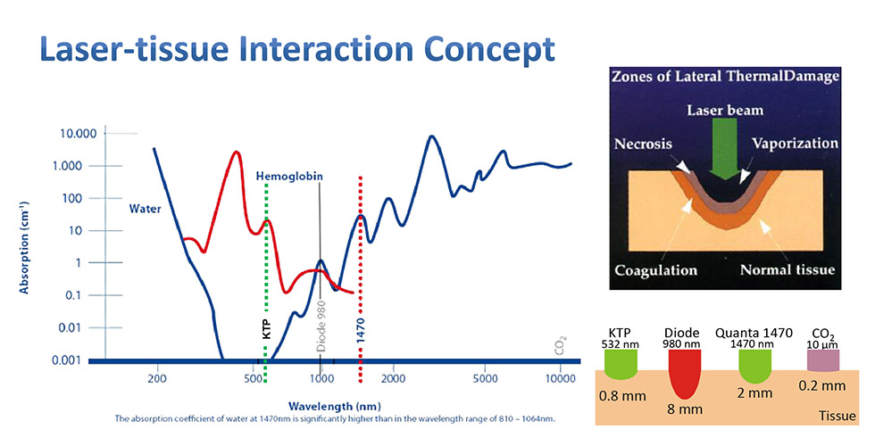 雷射光強度能量表及相互作用深度圖-iskinnose