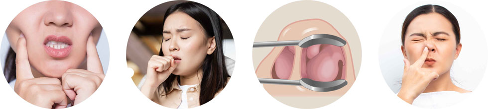 鼻炎造成的生活影響2-iskinnose