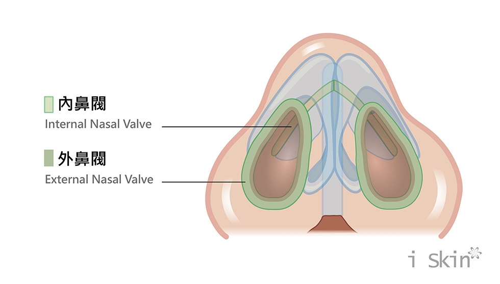 鼻閥解說1-iskinnose