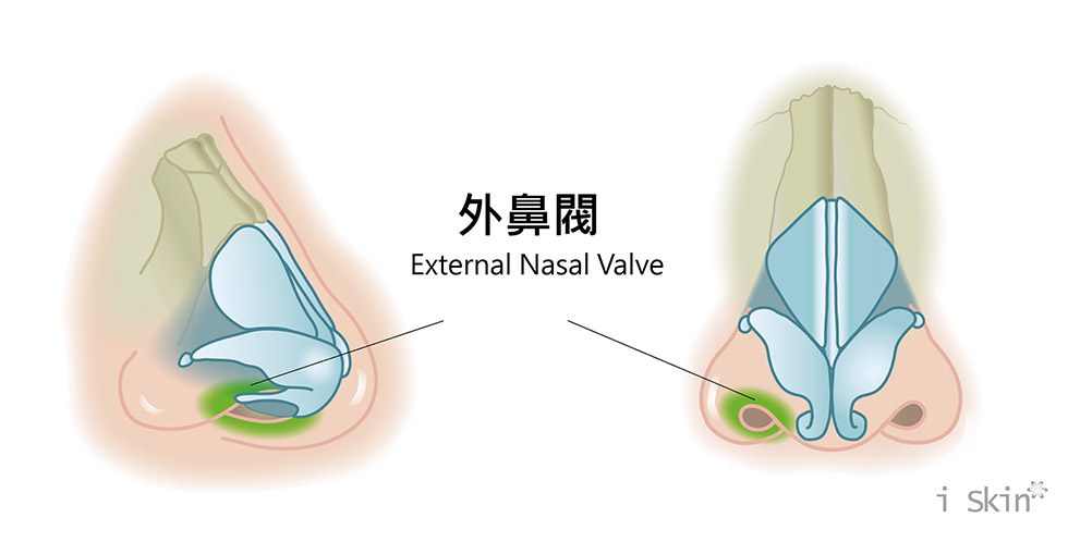 鼻閥解說3-iskinnose
