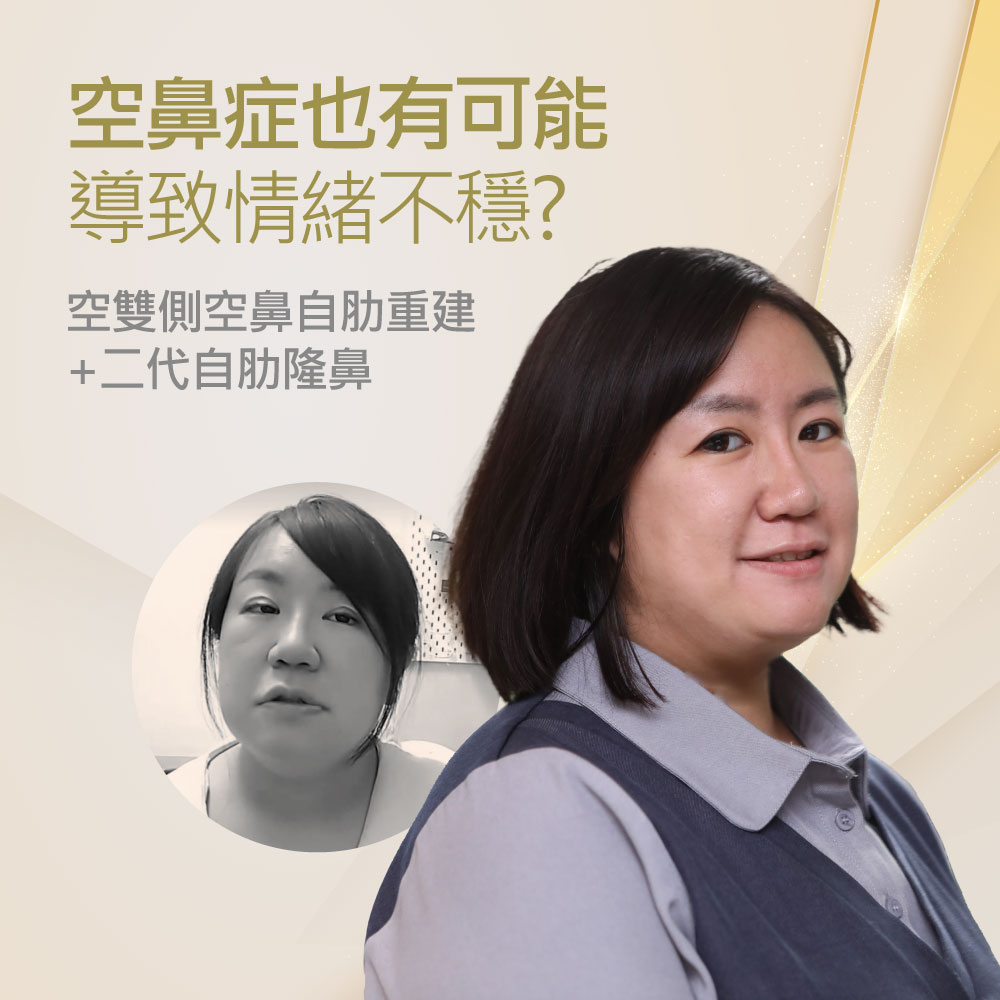 Chinese health promo poster: main text asks '鼻空症也有可能導致情緒不穩?' with subtitle about self-help nasal reconstruction; features a smiling woman in a blue vest and a grayscale circular portrait of another woman on a beige geometric background.