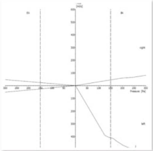 歪鼻案例分享iSkinnose-U先生3