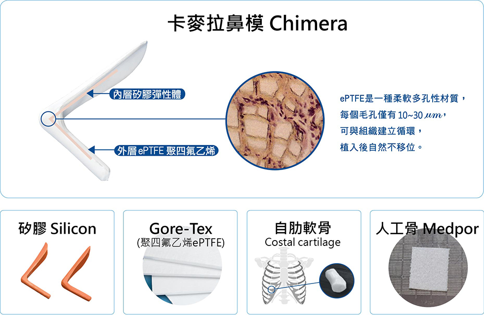 卡麥拉鼻模Chimera